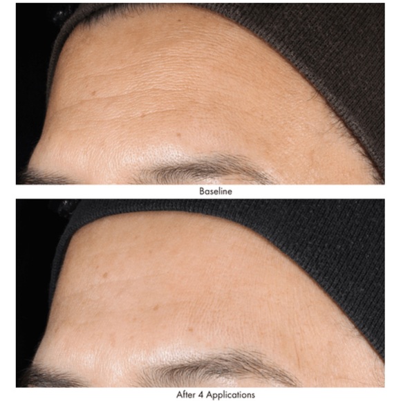 Obagi Skincare Obagi Revivify Multiacid Facial Peel Poshmark